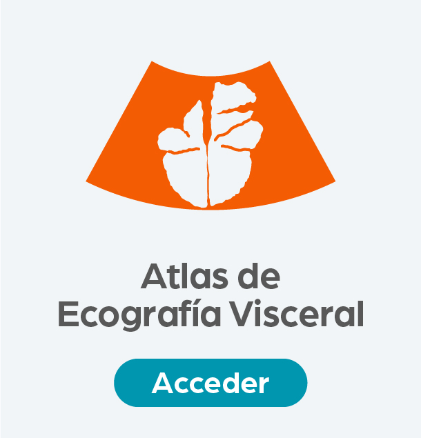 Acceso Atlas ecografía visceral
